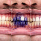 Blanqueador Dental Blanquísimo v34